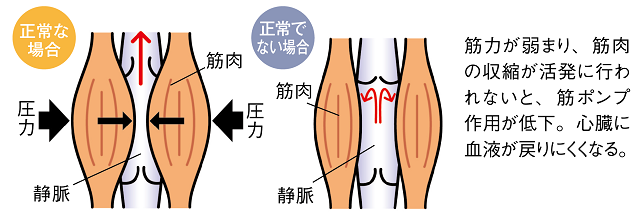 むくみの原因