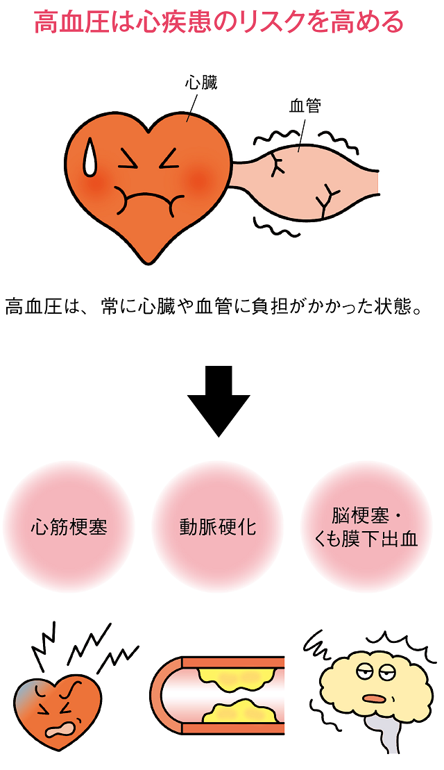 高血圧｜大正健康ナビ｜大正製薬