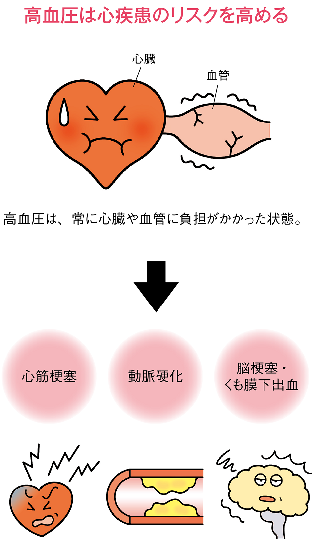 高血圧は心疾患のリスクを高める