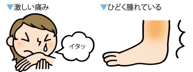 打撲・ねんざで、骨折や脱臼、靱帯断裂が疑われる場合１