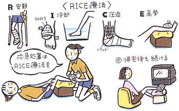 RICE療法