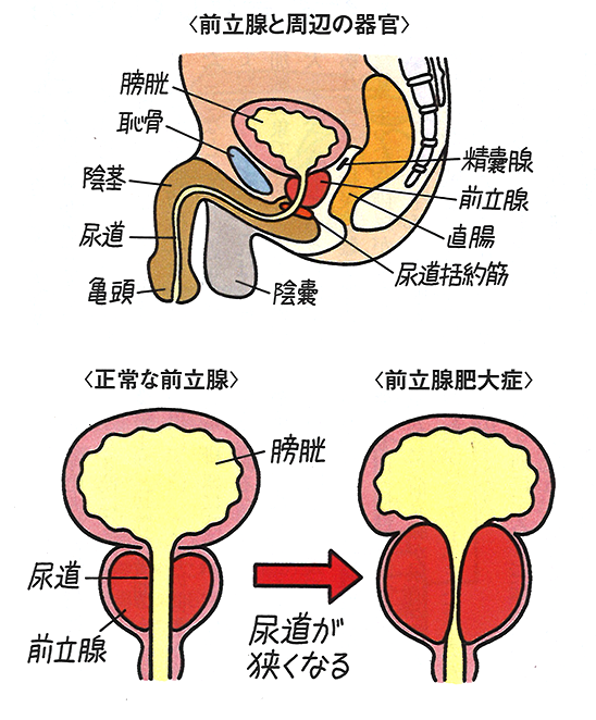 前立腺と周辺の器官