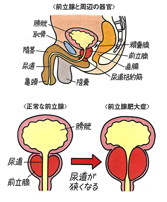 排尿 愛知医科大学泌尿器科学講座