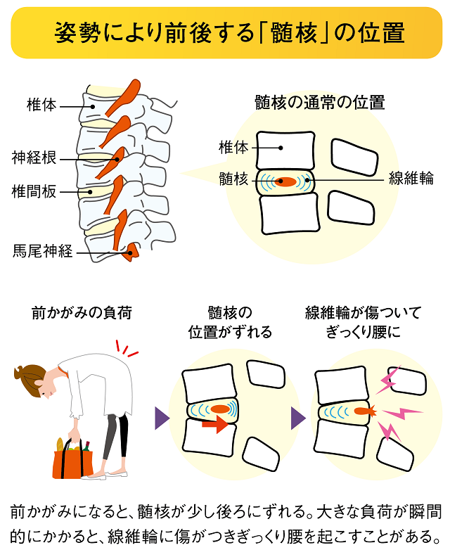 姿勢により前後する「髄核」の位置