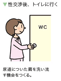 性交渉後、トイレに行く