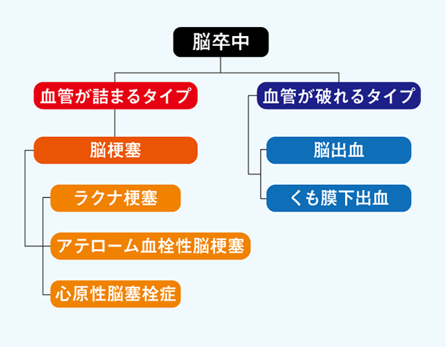 脳卒中の主な症状