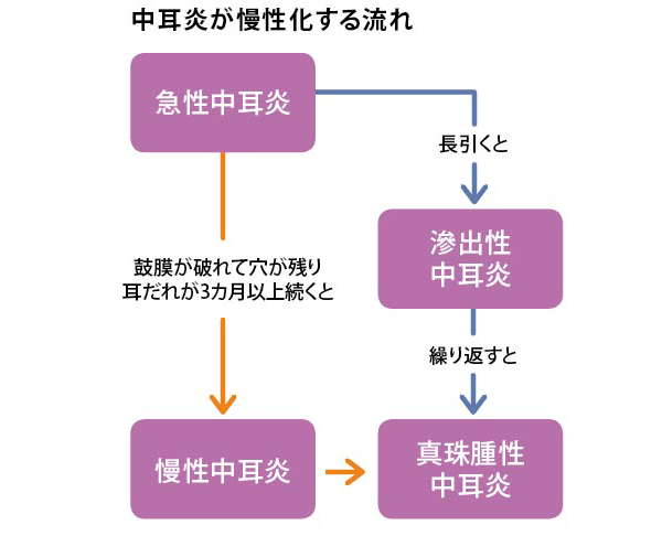 中耳炎が慢性化する流れ