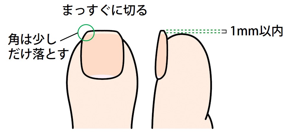 正しい爪の切り方