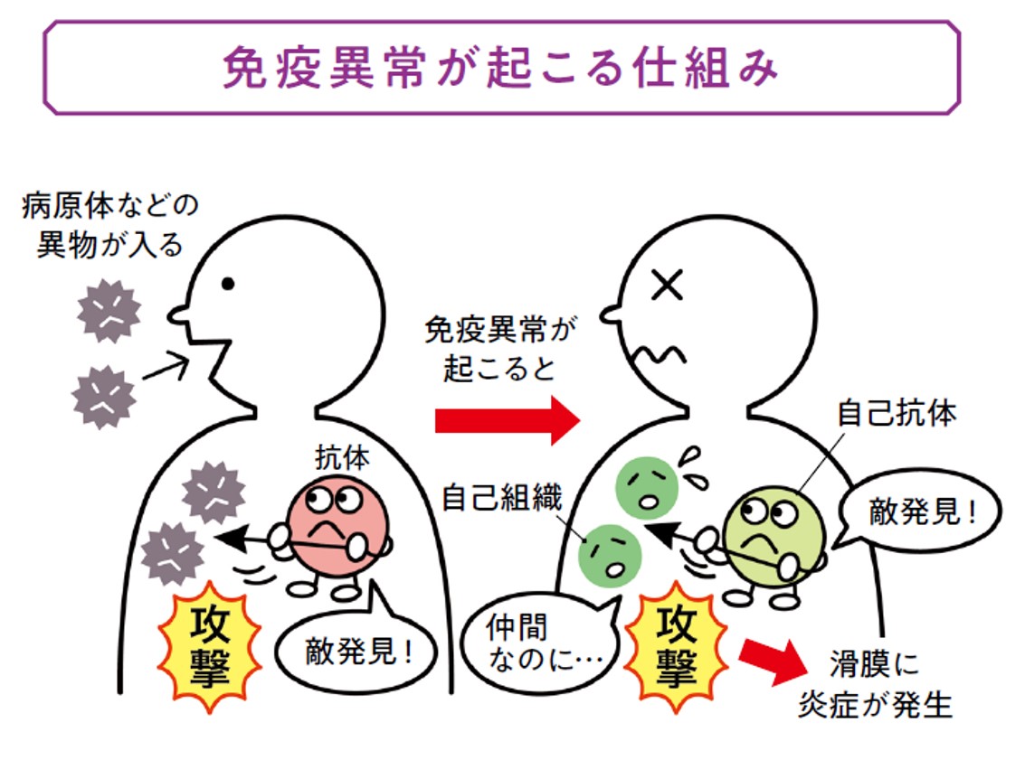 免疫異常が起こる仕組み