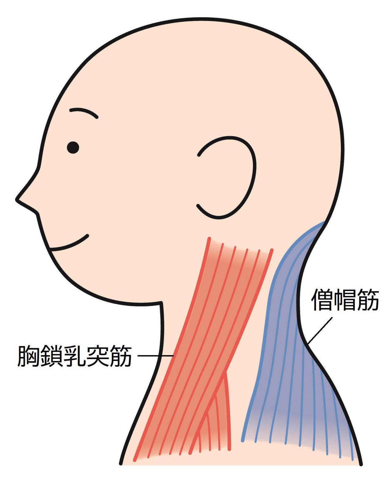 耳の下から胸に向かって伸びる胸鎖乳突筋や首の後ろにある僧帽筋を押して、強い痛みがあれば慢性上咽頭炎の可能性があります。
