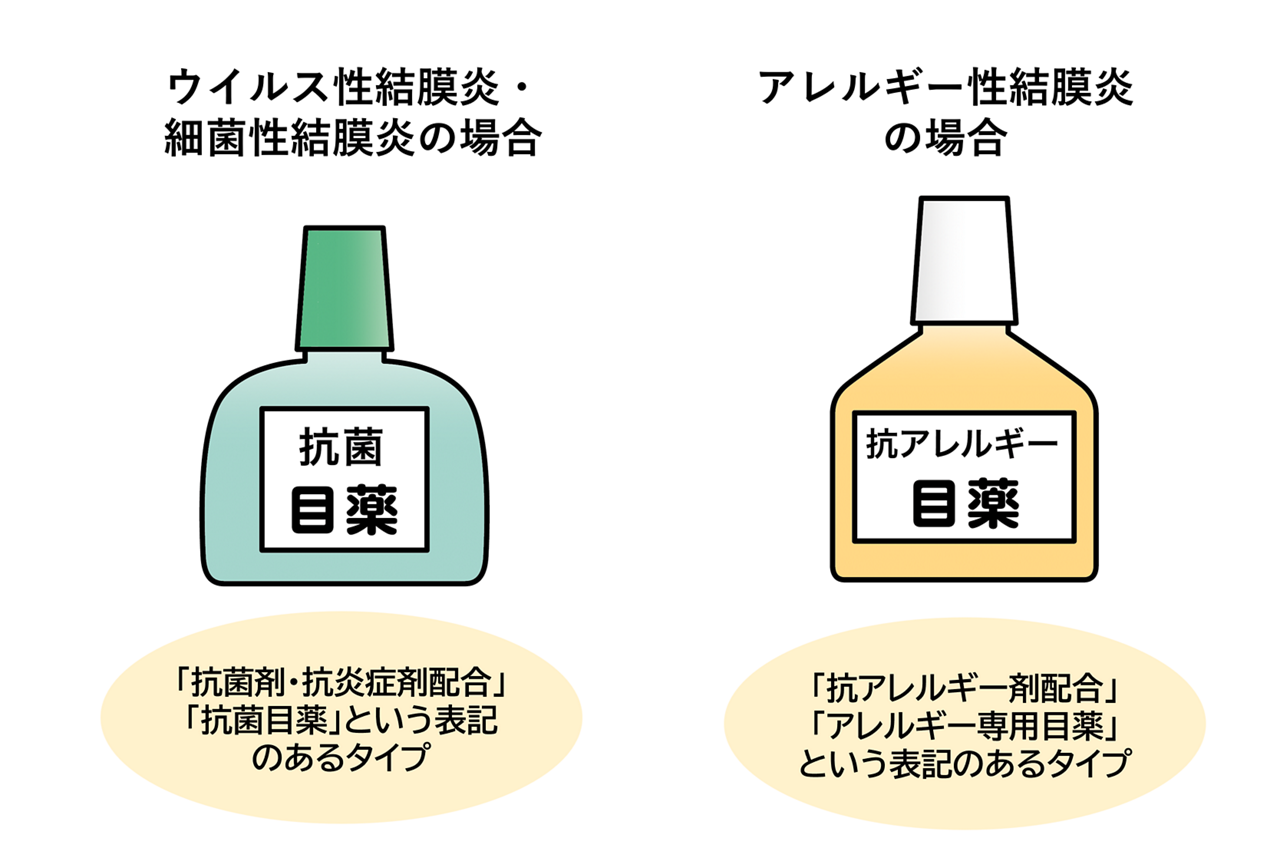 結膜炎の市販薬