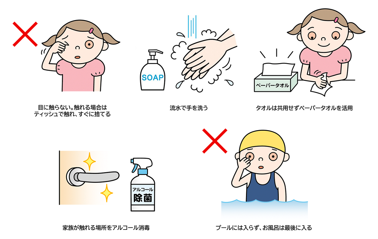 ウイルス性結膜炎の予防法