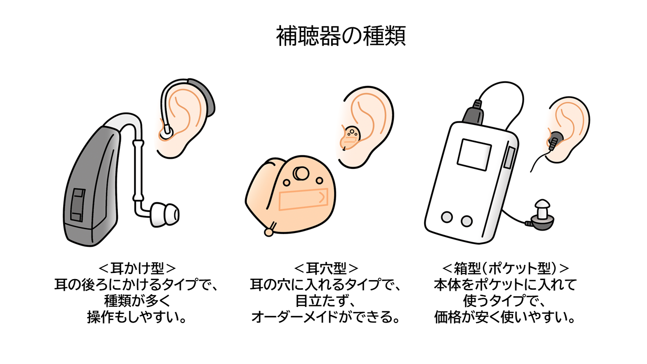 補聴器の種類。耳掛け型、耳穴型、箱型（ポケット型）