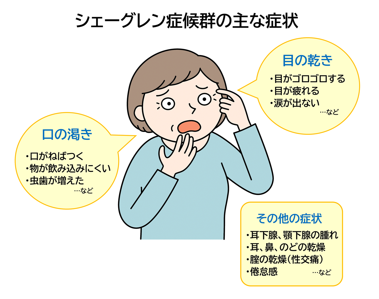 シェーグレン症候群の主な症状。口の渇き（口がねばつく、物が飲み込みにくい、虫歯が増えたなど）・目の渇き（目がゴロゴロする、目が疲れる、涙が出ないなど）・その他の症状（耳下腺・顎下腺の腫れ、耳・鼻・のどの乾燥、膣の乾燥・性交痛、倦怠感など）