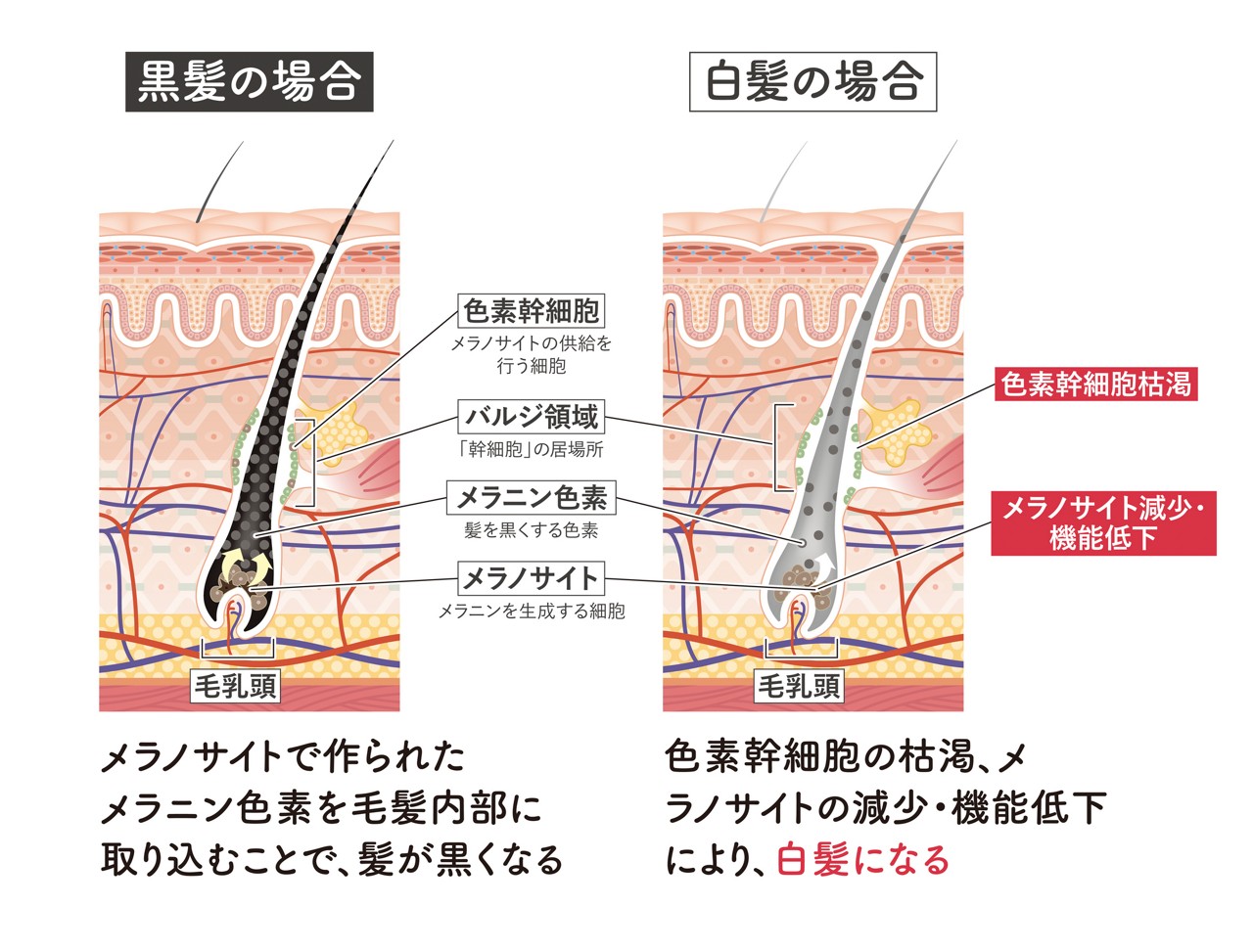 黒髪・白髪とメラニン色素の関係。黒髪の場合、メラノサイトで作られたメラニン色素を毛髪内部に取り込むことで、髪が黒くなる。白髪の場合、幹細胞の枯渇、メラノサイトの減少・機能低下により、白髪になる。