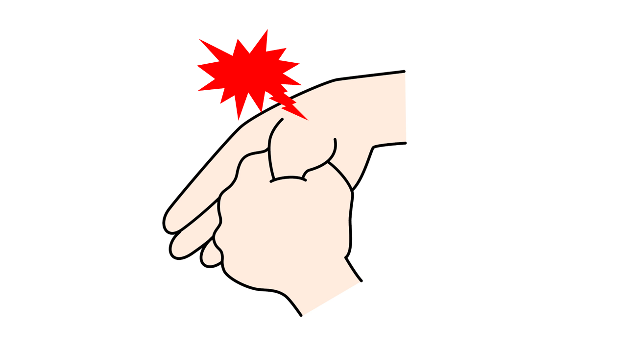 「ドケルバン病」を見極める「フィンケルシュタインテスト」。手の内側に倒した親指を小指側に引っ張ってみて、親指の付け根付近の痛みが強くなれば該当します。