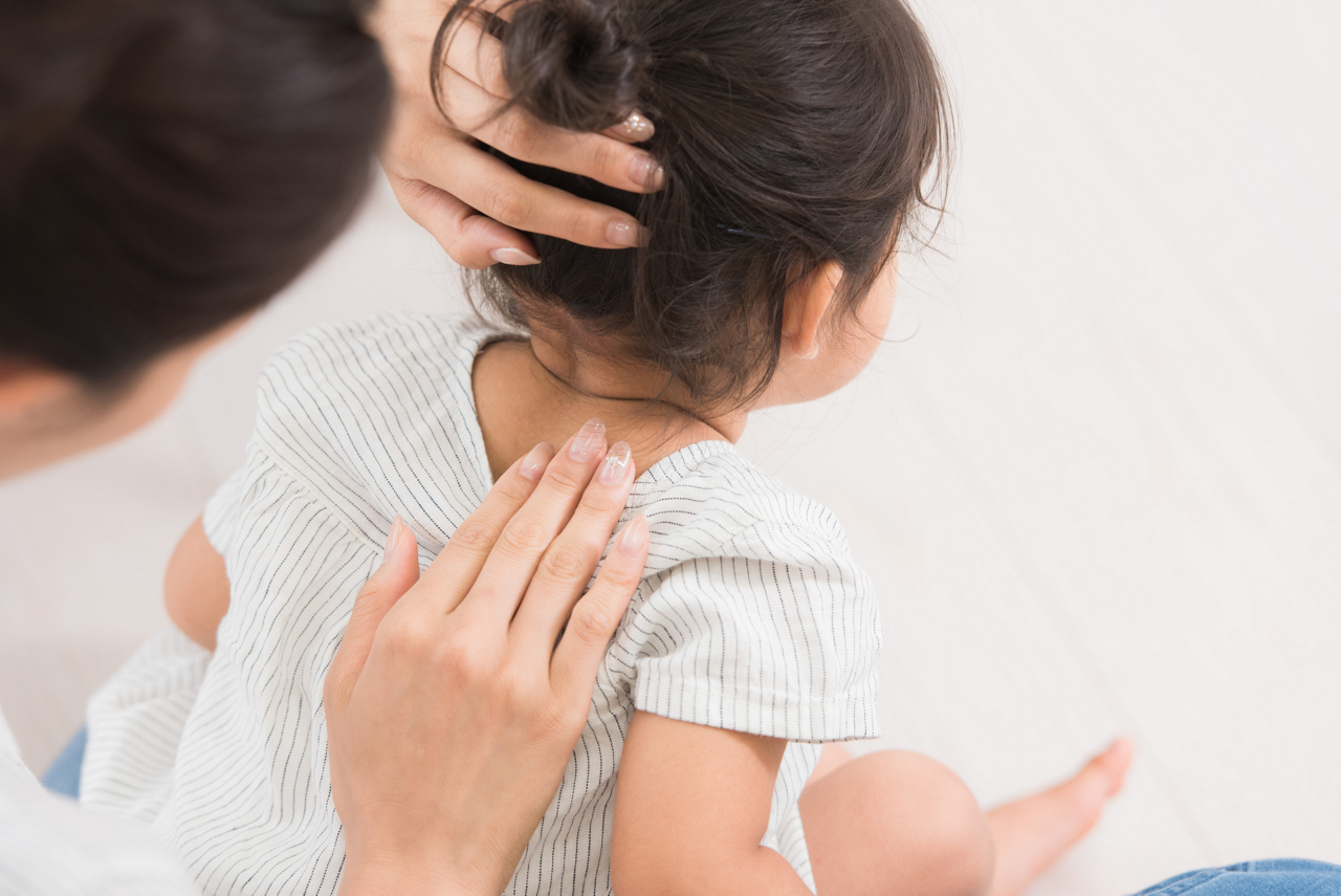 乳幼児があせもになりやすいのはなぜ？