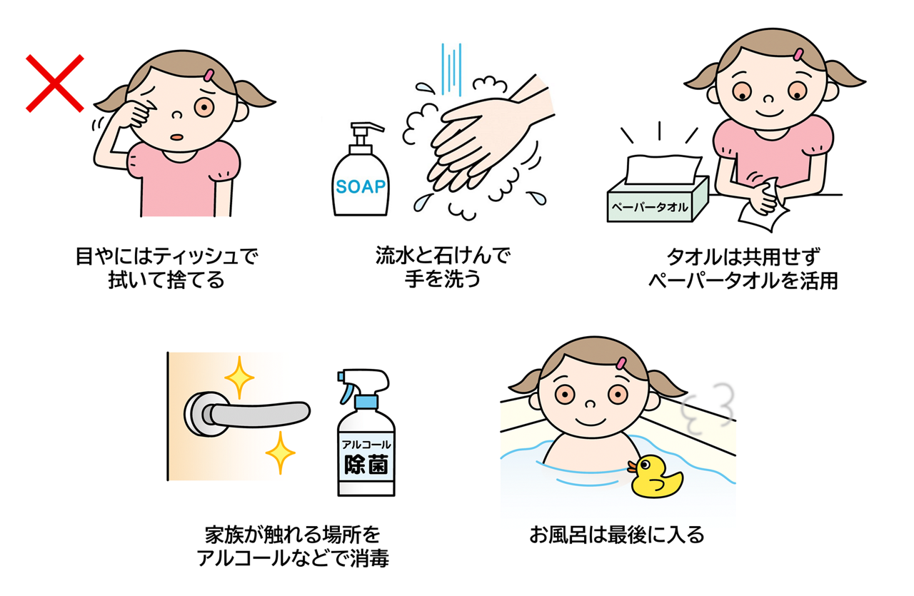 めやにはティッシュで拭いて捨てる。流水と石けんで手を洗う。タオルは共用せずペーパータオルを活用。家族が触れる場所をアルコールなどで消毒。お風呂は最後に入る。