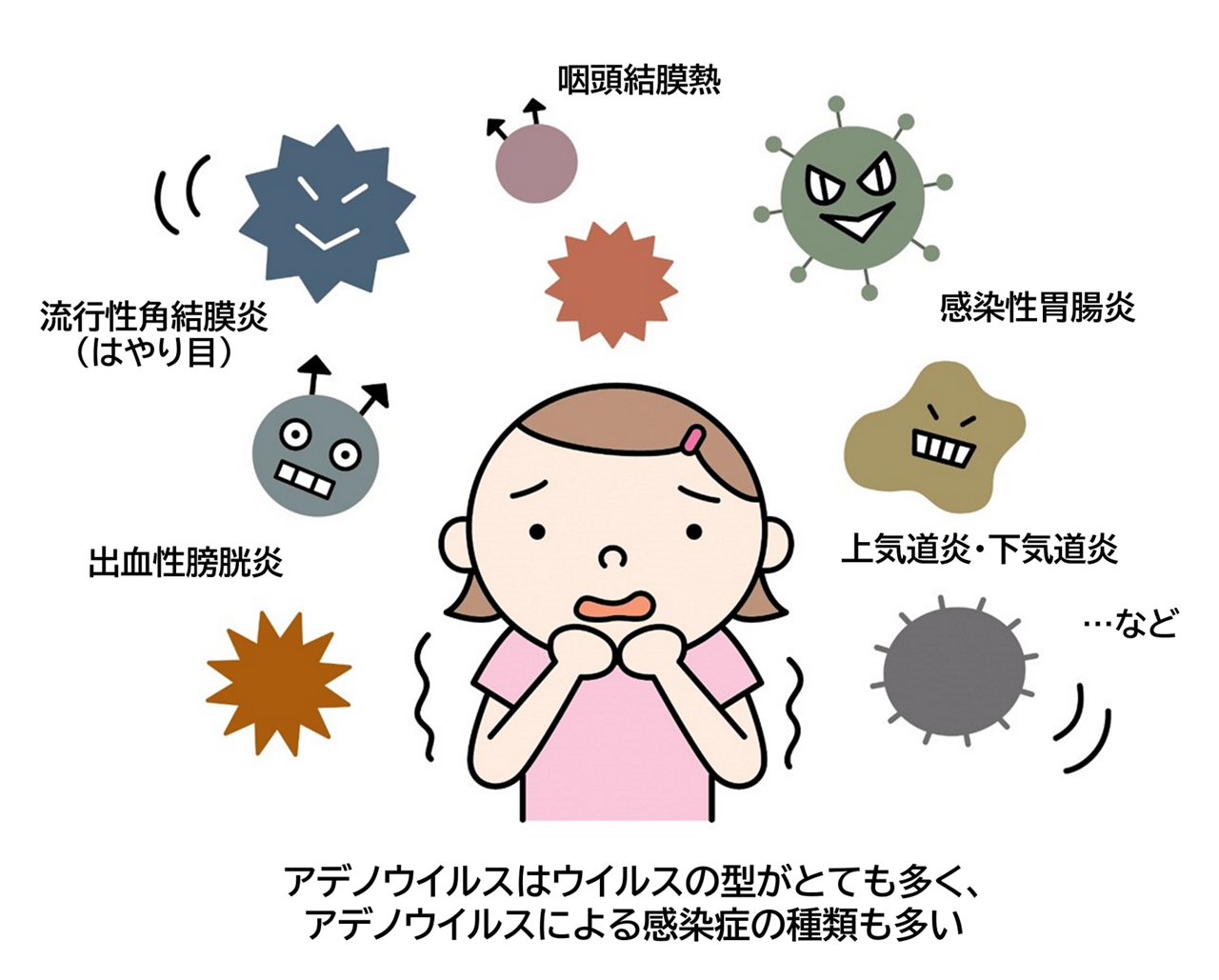 主なアデノウイルス感染症。咽頭結膜熱、流行性角結膜炎（はやり目）、感染性胃腸炎、出血性膀胱炎、上気道炎（かぜ）、下気道炎など。
