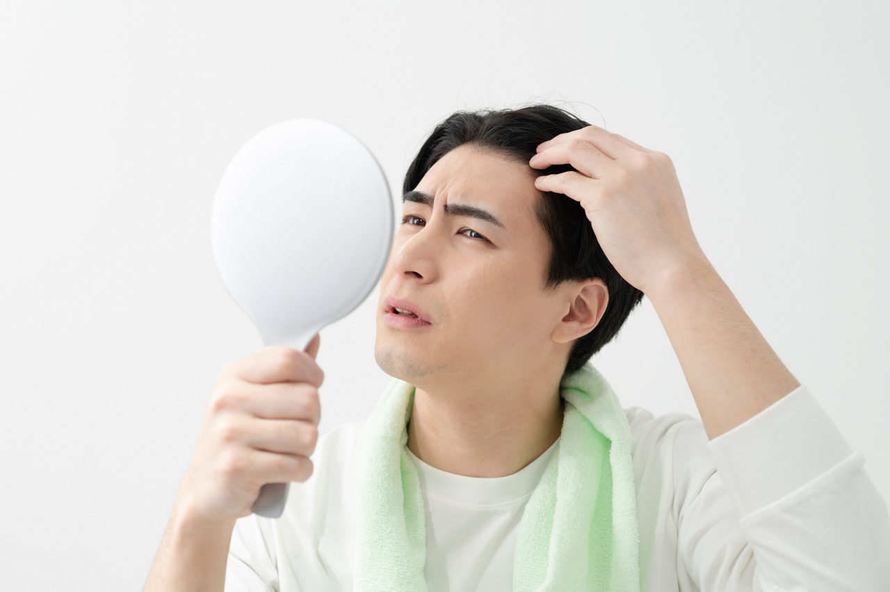 男性の薄毛・抜け毛（AGA/男性型脱毛症/壮年性脱毛症）