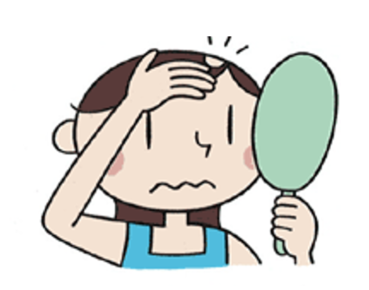 円形脱毛症のイラスト
