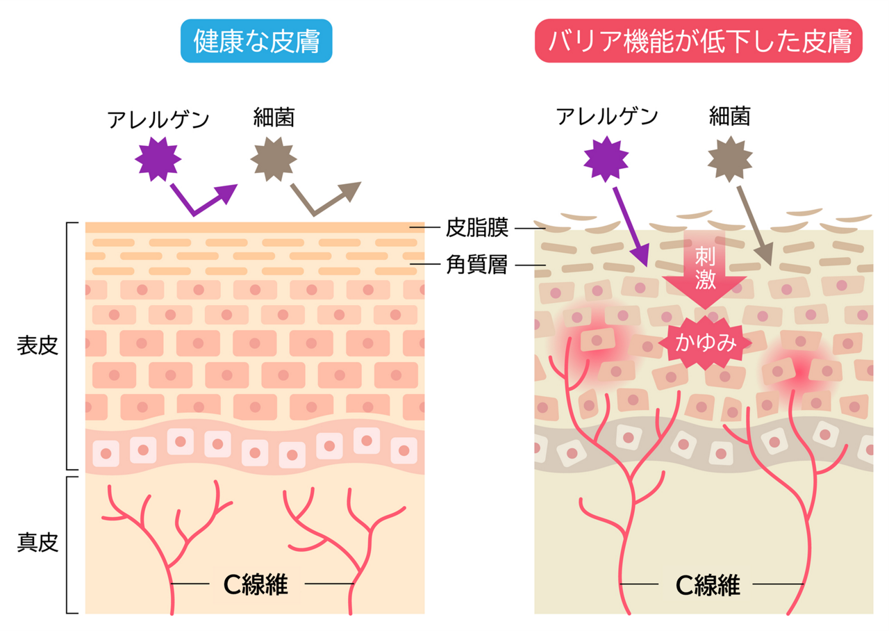 かゆみを感じる神経線維であるC線維の末端部分は、健康な肌では表皮と真皮の境界近くにありますが、バリア機能が失われ、乾燥した肌は外敵や異物が侵入しやすいため、角質のすぐ下にまでC線維が伸びるイメージ図