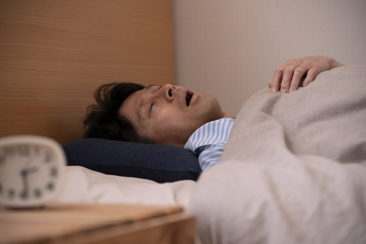 口呼吸で眠るドライマウスの男性のイメージ画像