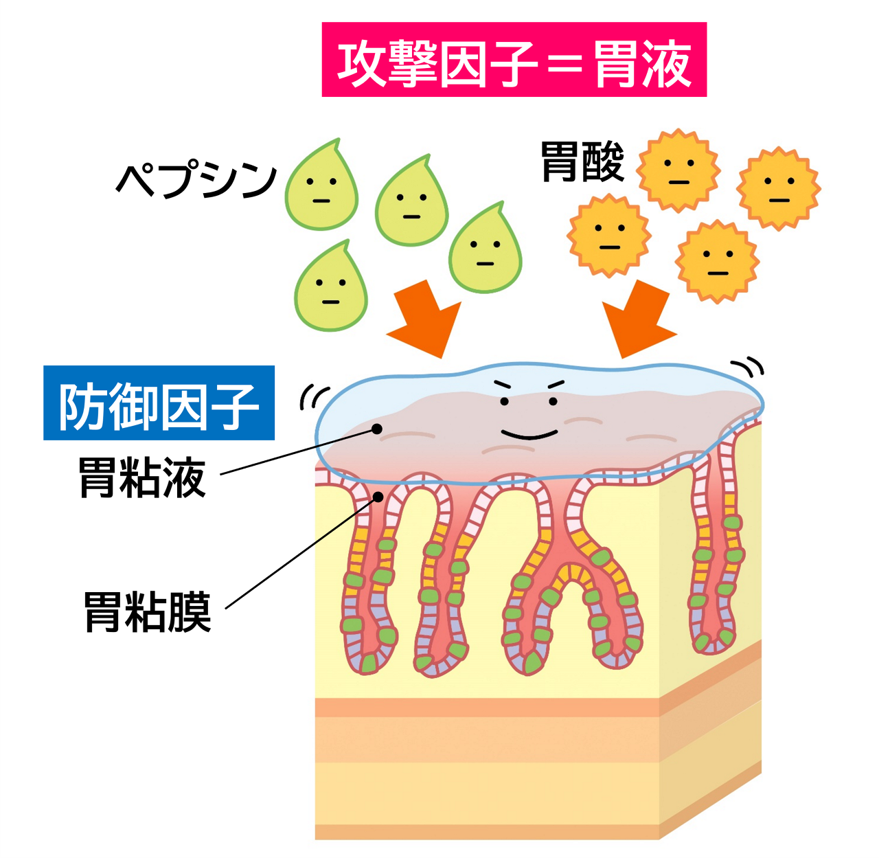 急性胃炎の攻撃因子は胃液（ペプシン・胃酸）で、防御因子には胃粘液。