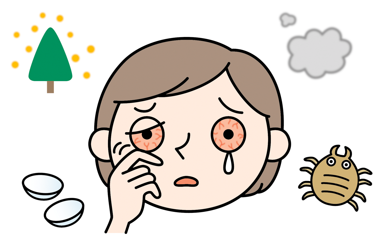 花粉やハウスダストで目のかゆみがある女性のイメージイラスト