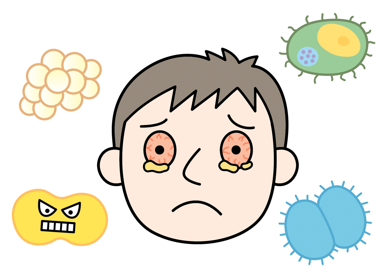 感染性結膜炎は、ウイルスや細菌への感染で目に炎症が起こり、目のかゆみがある男性のイメージイラスト
