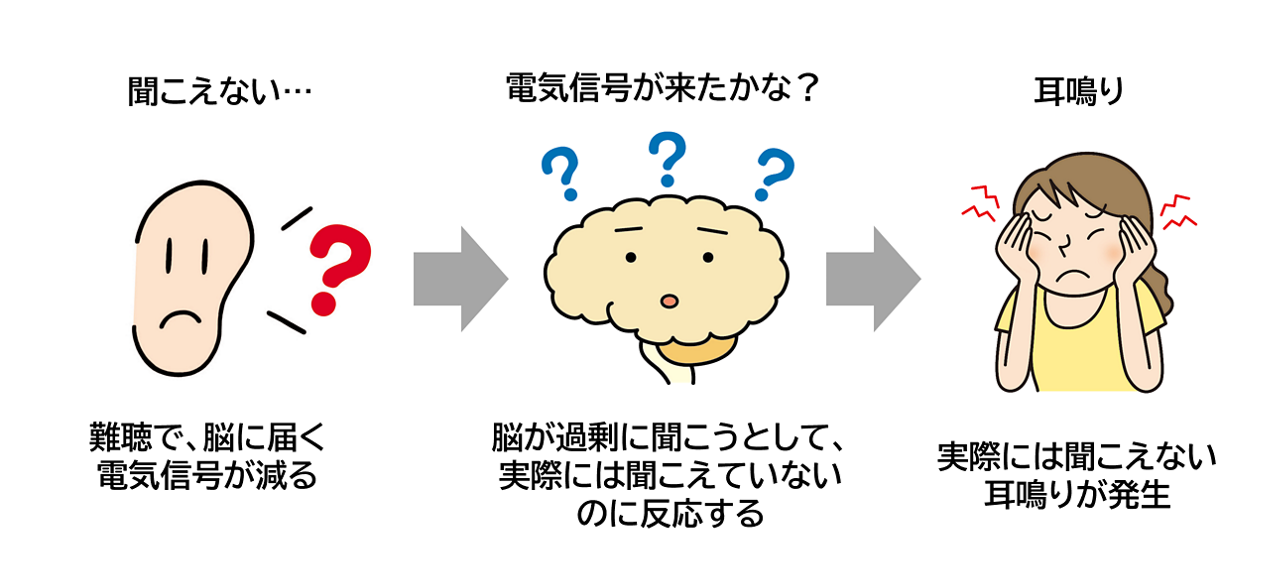 耳の聞こえが悪くなって蝸牛から脳に伝わる電気信号が減ってしまうと、脳が電気信号をキャッチしようとして過剰に反応するようになり、実際には音がしていなくても、脳が音を知覚してしまう。このように耳鳴りは、難聴によって不足してしまった音を補おうとして、脳が過剰に働き過ぎるくことで起きていると考えられる。