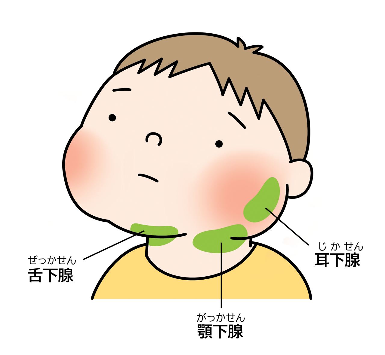 主な唾液腺には、耳の下の耳下腺、あごの下の顎下腺（がっかせん）と舌下腺があり、おたふくかぜはこれらの唾液腺を中心に炎症が広がります。