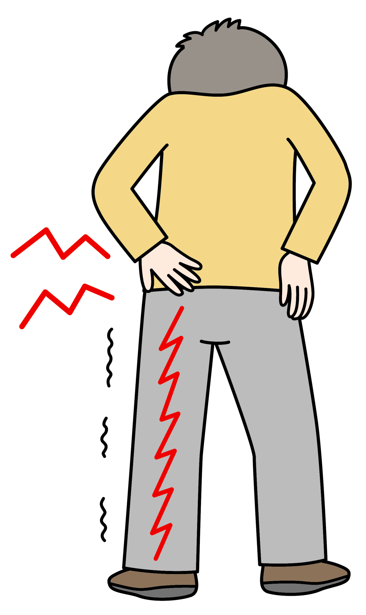 背筋を伸ばして立ったり歩いたりすると、お尻の下の大腿部につながる部分から下肢にかけて、しびれや痛みが出る状態を表したイメージイラスト