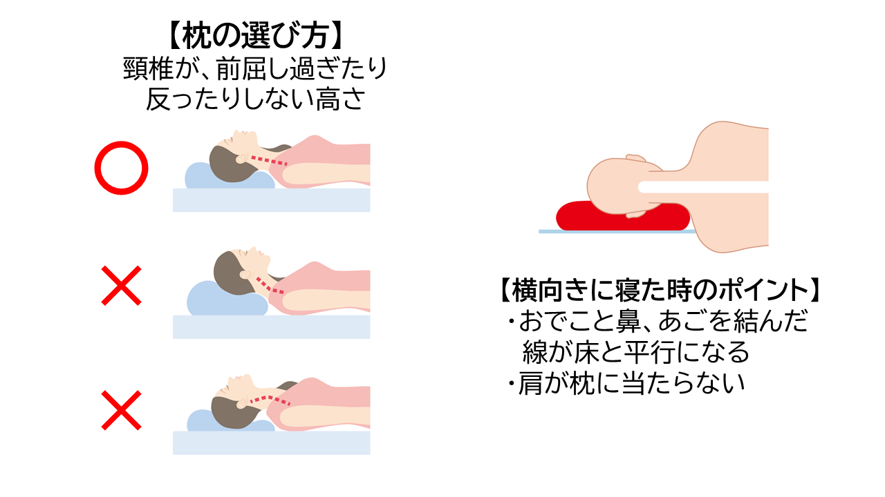 枕の選び方は、頚椎が前屈しすぎたり反ったりしない高さのもので、横向きに寝た時に、おでこと鼻・あごを結んだ線が床と平行になり、肩が枕に当たらないのがポイント。