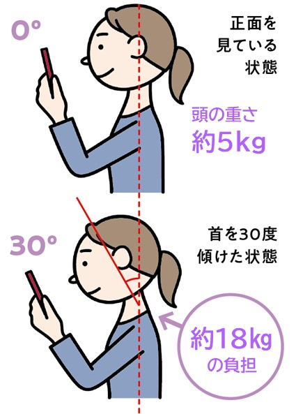 人の頭の重さは、平均で５kg程度。頭が前に傾くと、首や肩にかかる負荷が何倍にも増し、スマホ使用時などに多い30度の前傾姿勢では、約18kgにもなります。