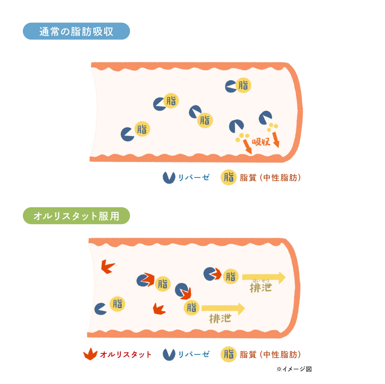 通常の脂肪摂取とオルリスタット服用時の脂肪摂取の違いのイメージ図。オルリスタットはリパーゼと結合して不活性化させ、脂肪が分解されるのを防ぎ分解されなかった脂肪は吸収されることなく、そのまま便として排出排泄されます。